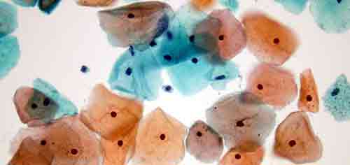 Pap Test